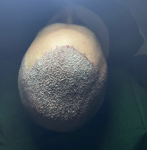 Photo from customer review