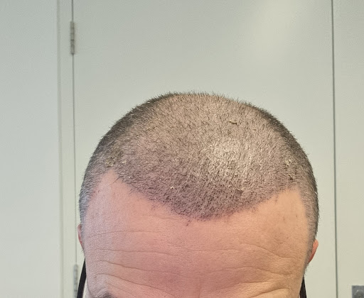 Photo from customer review