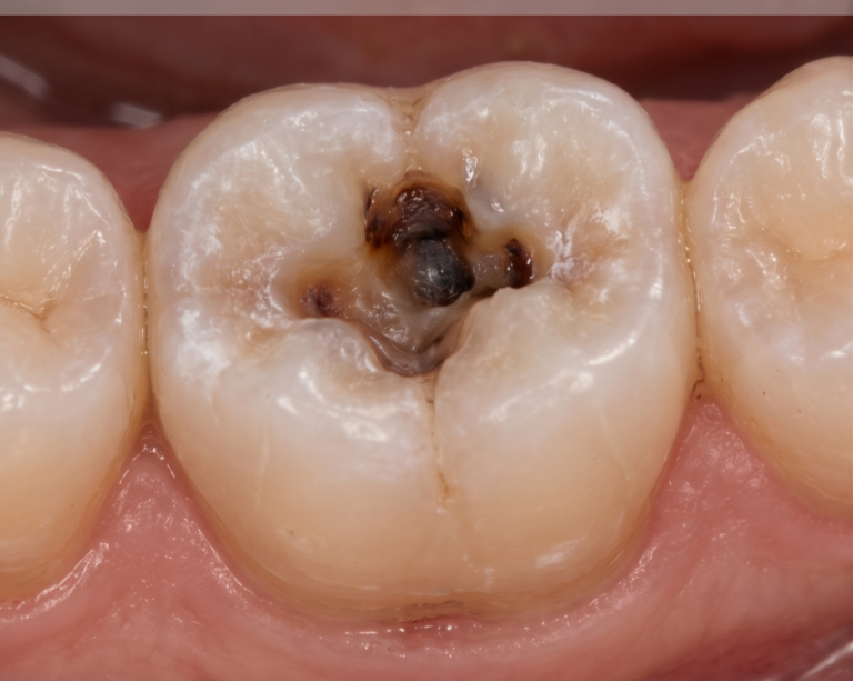 Before treatment